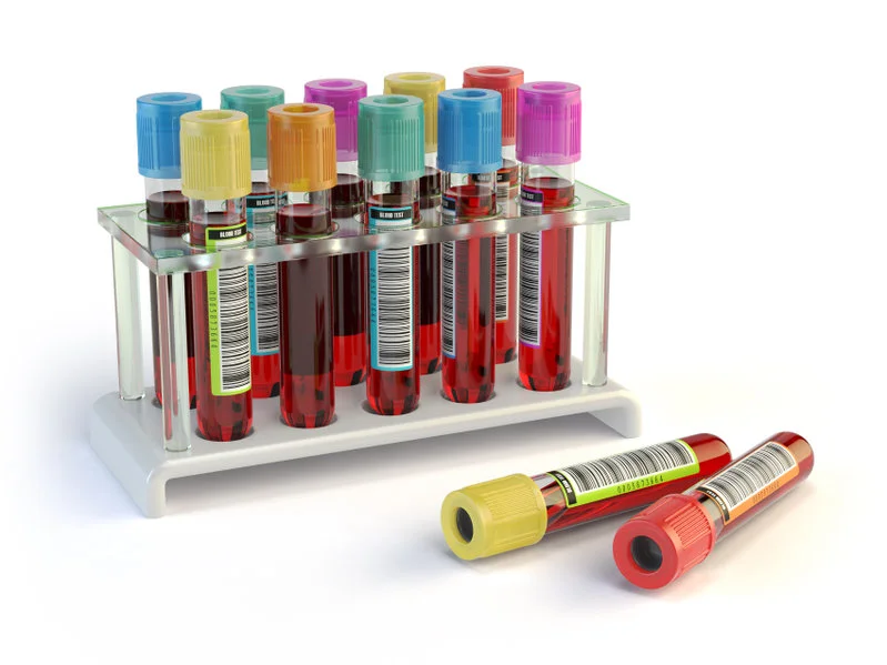 Pre-operative blood tests