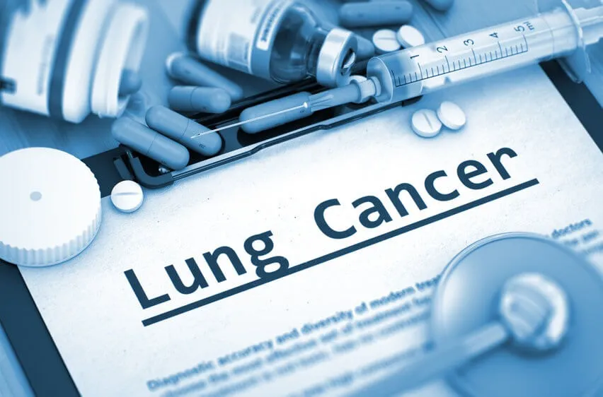 Lung Cancer