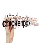 Chickenpox
