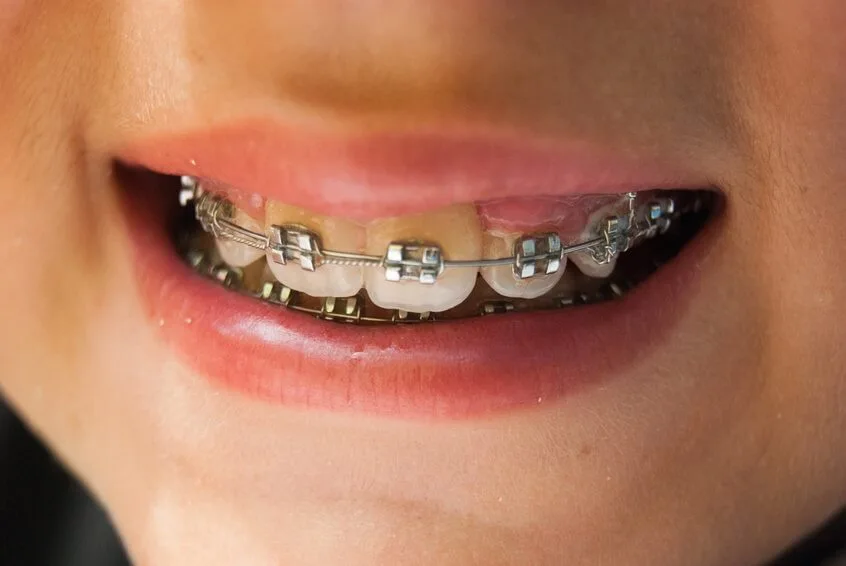 Orthodontics