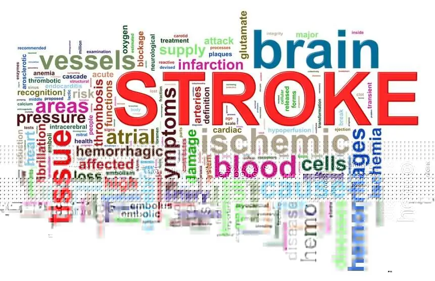 Stroke symptoms FAST test recognition