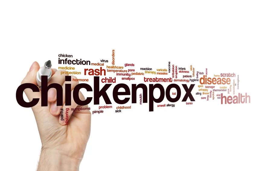 Chickenpox rash symptoms and stages