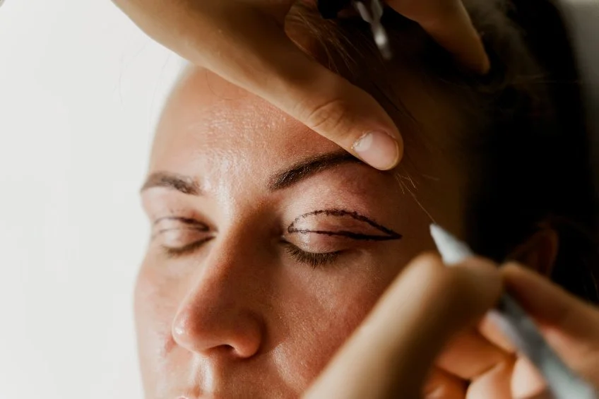 Eyelid surgery blepharoplasty cosmetic overview